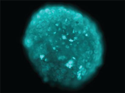 Fluorescence microscopy image showing P-selectin–targeting nanoparticles penetrating lab-grown tumor tissue